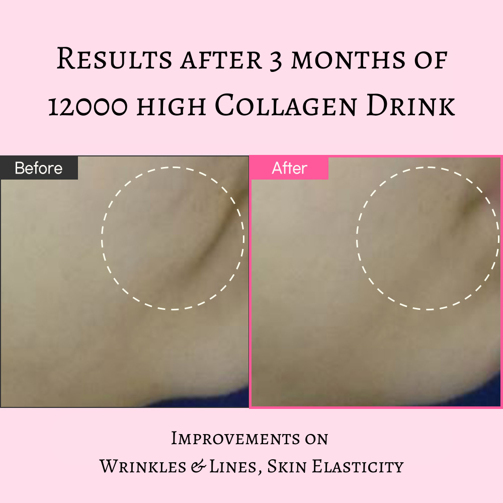 12000 High Collagen Drink - Dewology