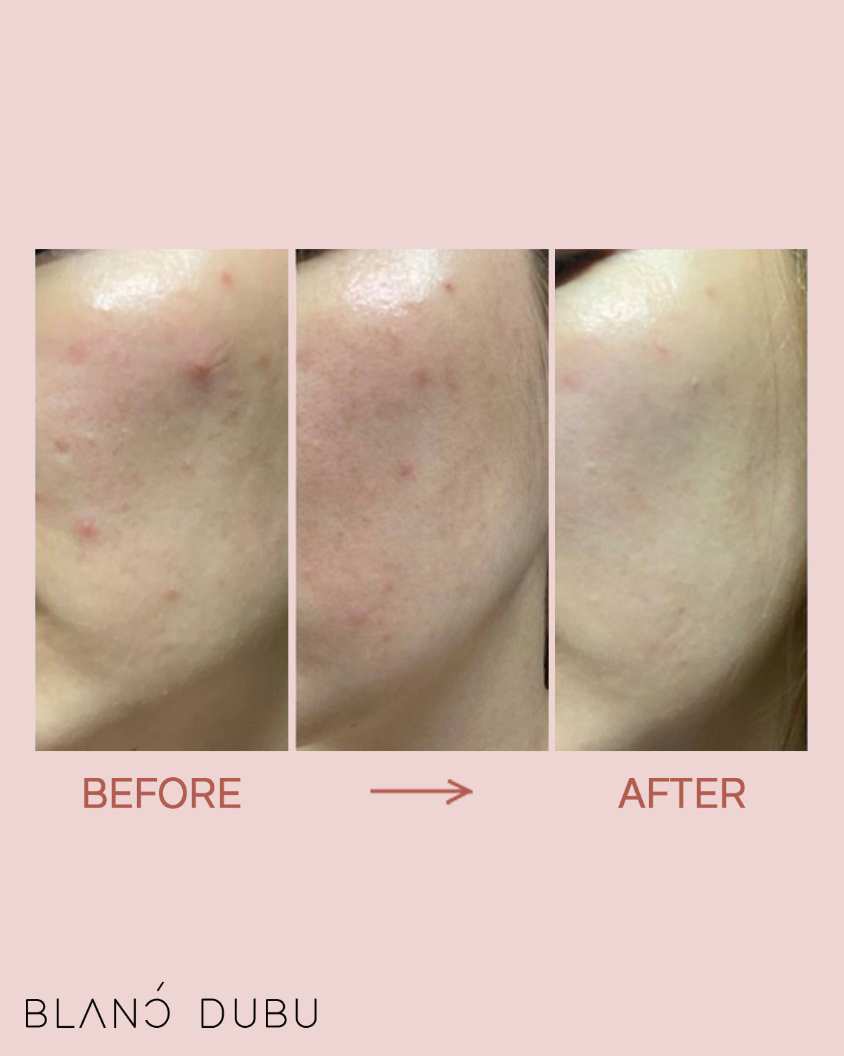 Donkey Collagen Cream - Dewology