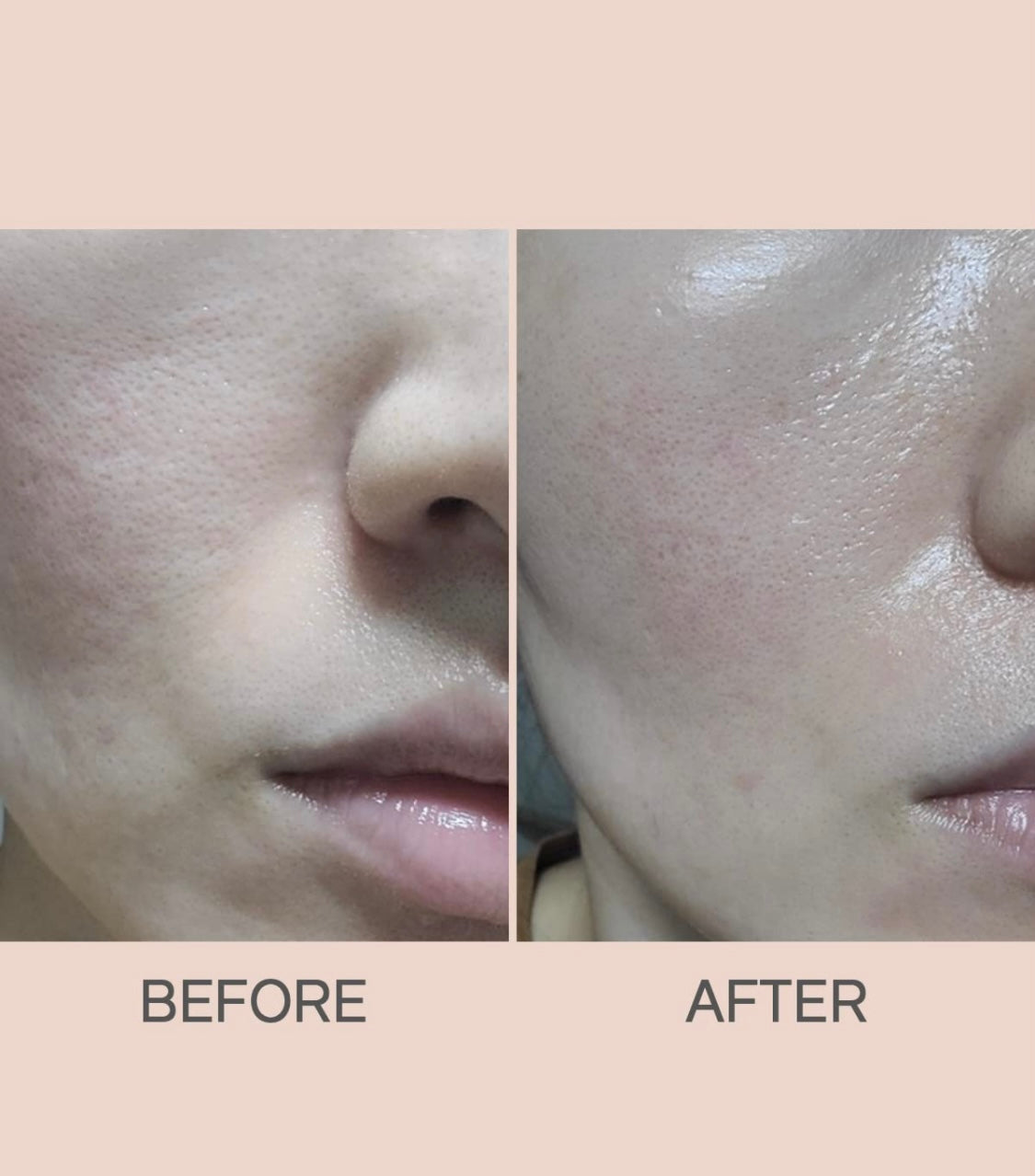 Collagen Hydrogel Mask - Dewology